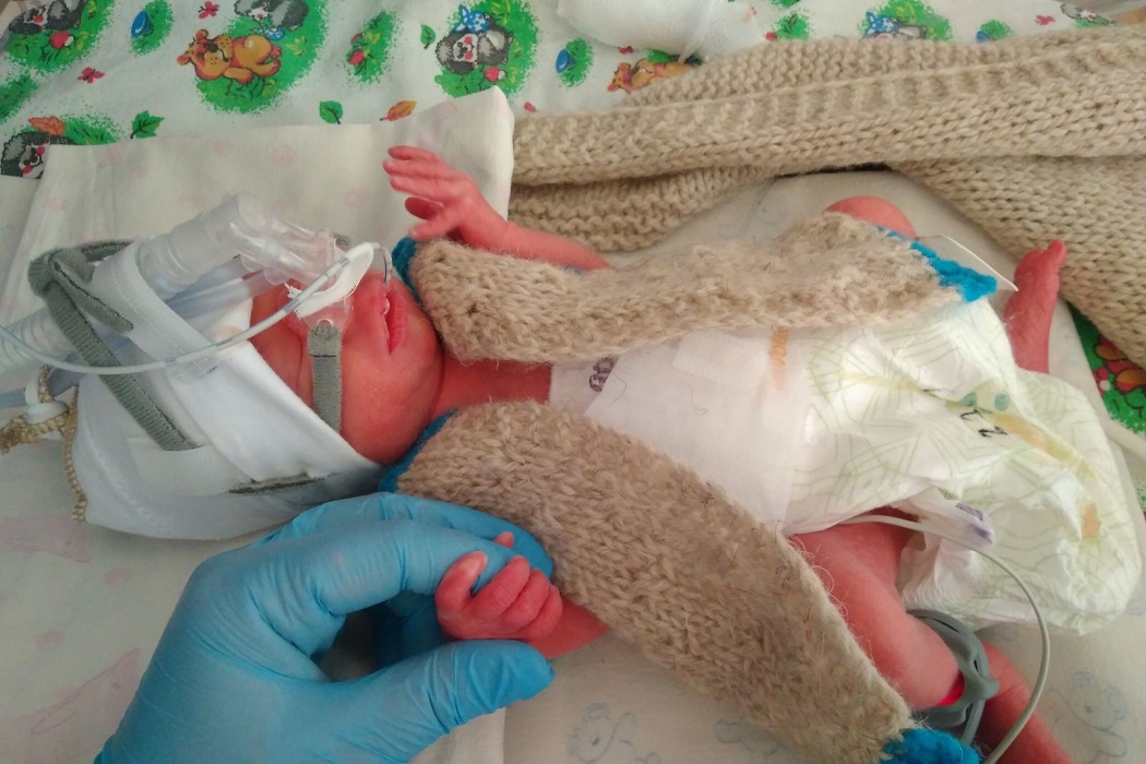 Врачи Ишима спасли 800-граммового малыша, рождённого на 26 неделе беременности 1