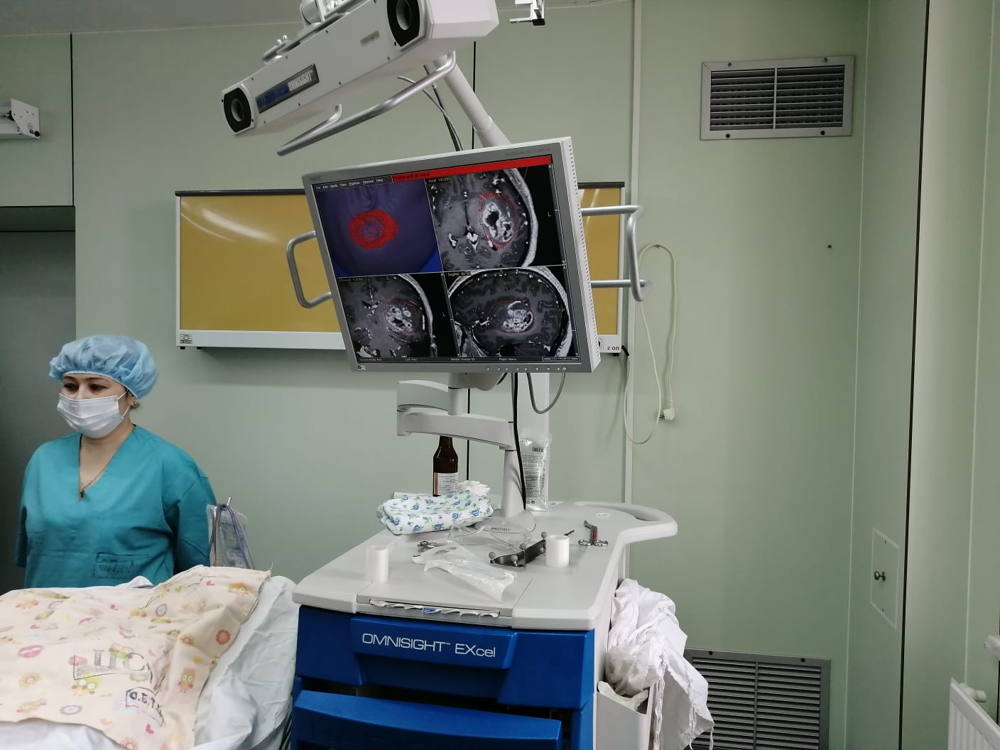 Врачи Сургута с помощью переводчика удалили опухоль мозга пациентке из Китая